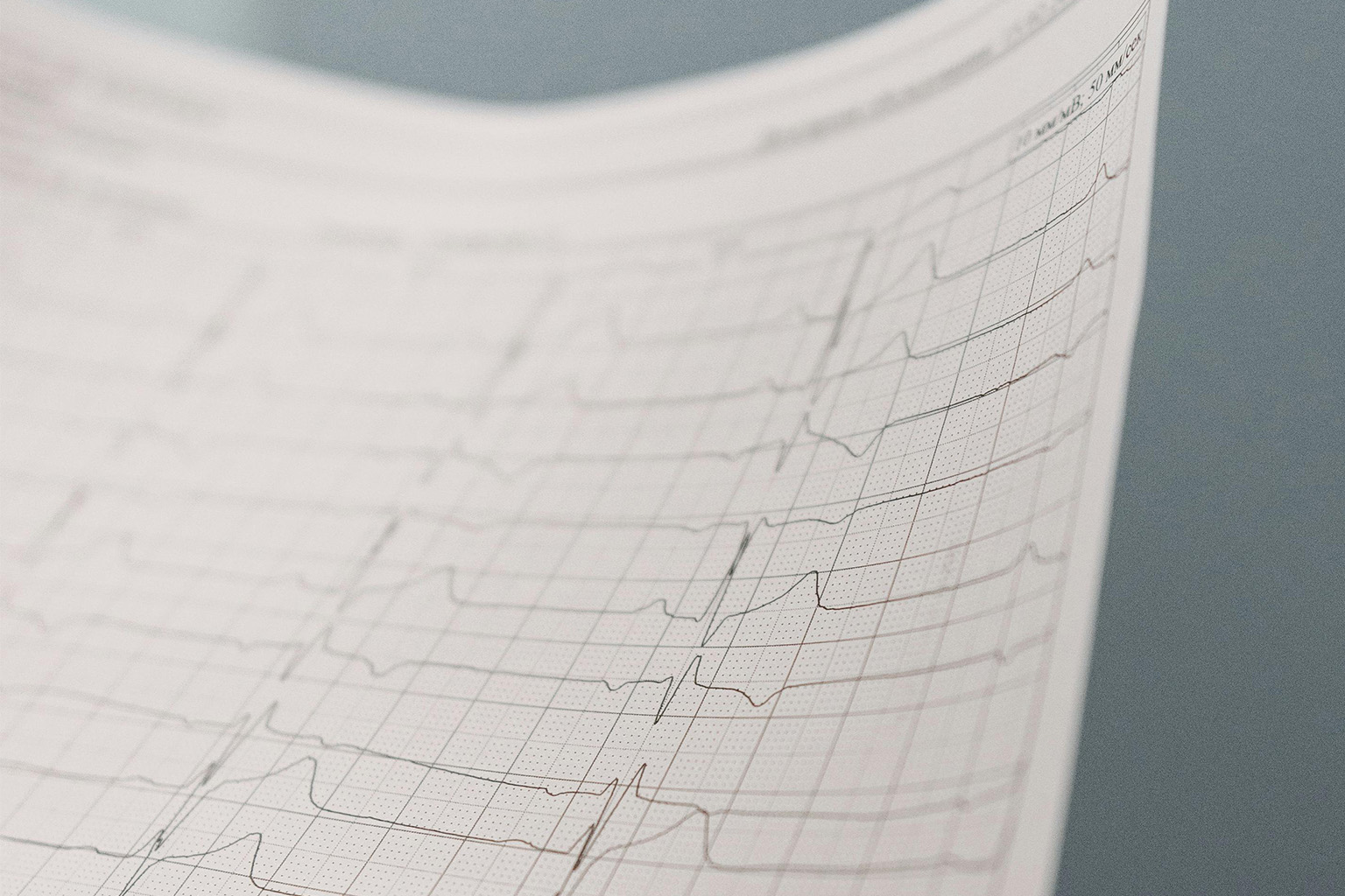 Papier do EKG, EEG i KTG — czym się różnią i który wybrać?