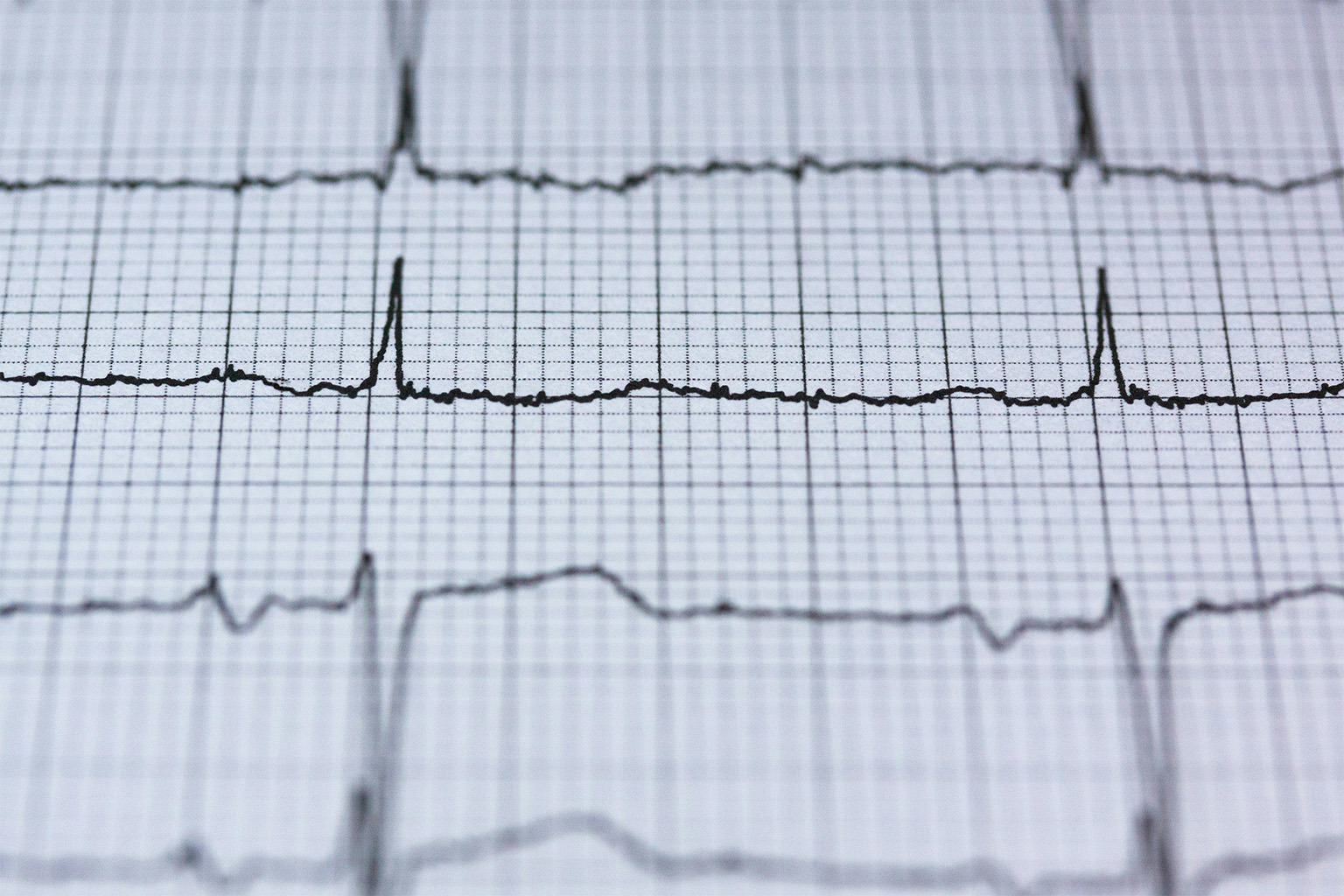 Najczęstsze problemy ze sprzętem EKG — jak je diagnozować i naprawiać?