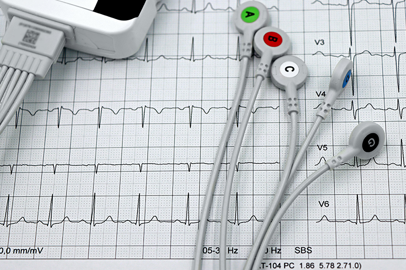 Papiery do EKG, EEG i KTG – jak dobrać odpowiedni papier do aparatury medycznej