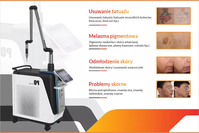 Super Picosecond, urządzenie do usuwania tatuaży i rewitalizacji